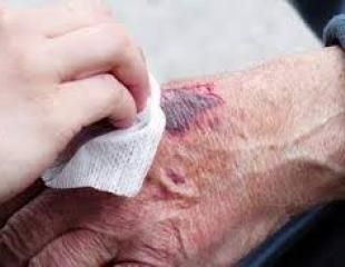 Chacun sait que, pour soigner une plaie, il faut commencer par la nettoyer soigneusement. Une plaie mal nettoyée va s’infecter