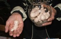 Provoquer un avortement à distance : rituel pour avorter une grossesse a distance mediacongo