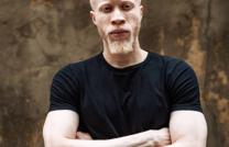 Je te célébrerai parce que j’ai été fait d’une étonnante et admirable manière. Psaume 139. 14 mediacongo