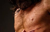 Il(Jésus)a été blessé pour nos transgressions, il a été meurtri pour nos iniquités ;le châtiment qui nous donne la paix a été sur lui, et par ses meurtrissures nous sommes guéri.Es mediacongo