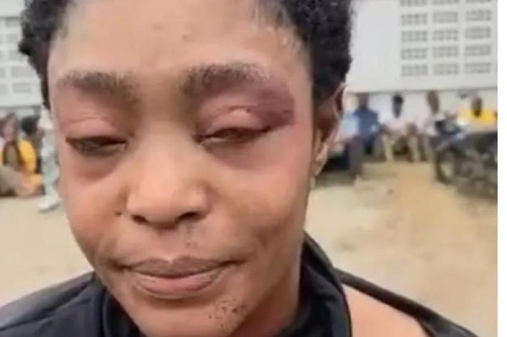 Kinshasa : la CNDH condamne la diffusion des images d’une femme déshabillée après un braquage à la Rawbank Victoire