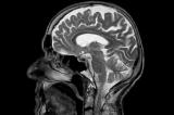 Et si l’on pouvait un jour pirater le cerveau ?  