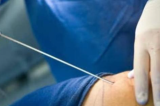 Kinshasa: Injections clandestines  BBL, les  ministres de la Justice et de la Santé appelés à traquer les charlatans