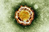 Coronavirus: un premier mort aux États-Unis 