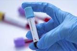 Covid-19 : la RDC connaît une diminution des cas de contamination