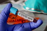 Bulletin épidémiologique du covid-19 : 116 nouveaux cas confirmés, dont 112 à Kinshasa et 4 dans le Haut-Katanga 
