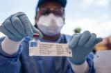Lutte contre Ebola : enfin des produits de l'espoir ?