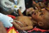 La malnutrition cause la mort des enfants de moins de 5 ans au pays