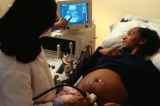 USA : mortalité record pour les femmes noires dans les maternités lors des accouchements.