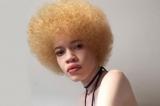 Diandra Forrest, premier mannequin albinos à devenir égérie