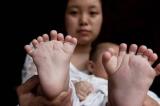 En Chine, un bébé est né avec 15 doigts et 16 orteils !
