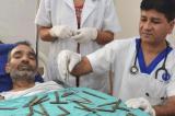 En Inde, un policier opéré après avoir ingurgité 40 couteaux