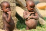 Malnutrition : six millions d’enfants de moins de 5 ans atteints chaque année en RDC