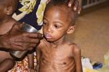 Lomami : Environ 600 cas de malnutrition enregistrés à Bakwa Mulumba