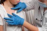 Mpox : un nouveau variant découvert en Allemagne