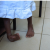 Infos congo - Actualités Congo - -Maniema : 87 enfants guéris de la malformation de pied bot en 2023