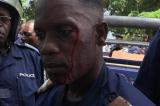Policiers tués et blessés à l'UNIKIN: Le général Sylvano Kasongo s’étonne du silence des ONG et organismes des droits de l'homme
