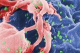 Vaccin anti-VIH : bientôt le bout du tunnel