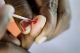 Afrique du Sud: les kits de dépistage du VIH désormais en vente libre