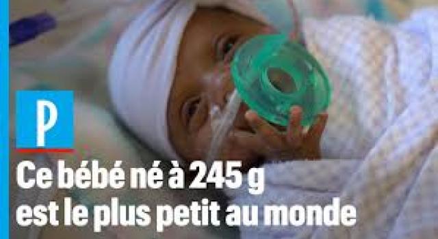 Mediacongo Net Actualites Californie Le Plus Petit Bebe Ne En Vie Au Monde Quitte L Hopital Apres Cinq Mois De Soins Mediacongo Net Actualites Californie Le Plus Petit Bebe Ne En Vie Au Monde Quitte L Hopital Apres Cinq Mois De Soins