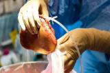 Assemblée nationale : La proposition de loi sur la transplantation des organes du corps humain rejetée