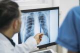 Le nombre de morts dues à la tuberculose remonte en Europe, selon l’OMS