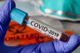 Covid-19 : l’Afrique veut produire ses propres vaccins