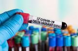 Covid-19 : que sait-on du variant Delta ?